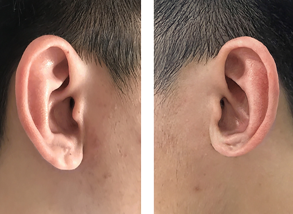 Cosmetic Restoration