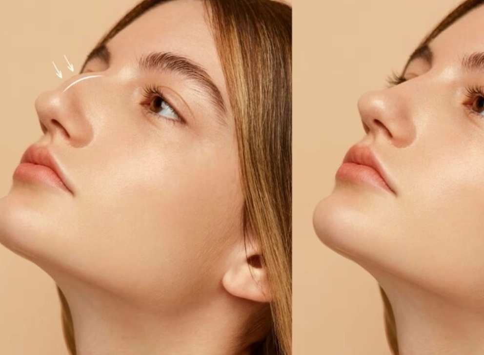 Cosmetic Restoration