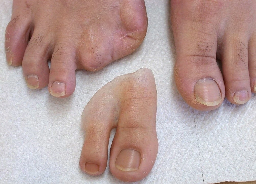 Cosmetic Restoration