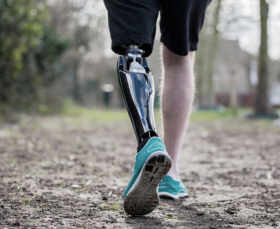 Lower Limb Prosthetics