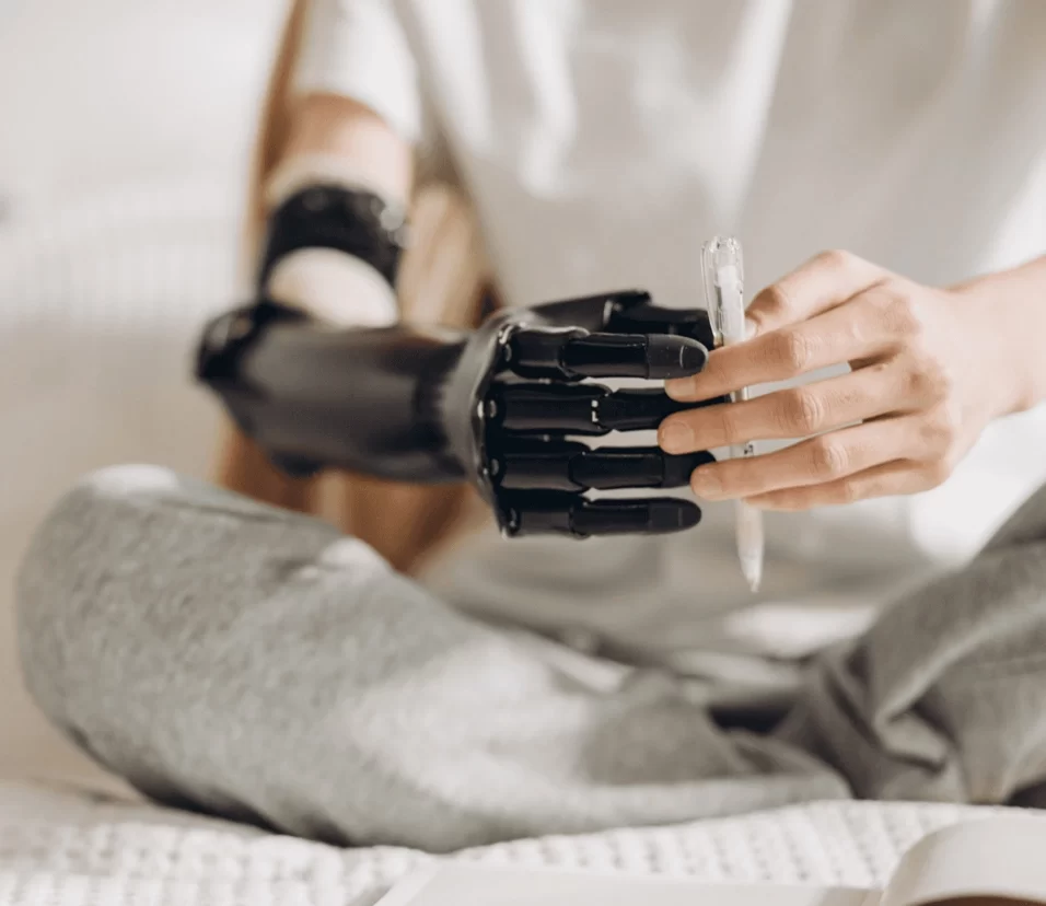 Upper Limb Prosthetics