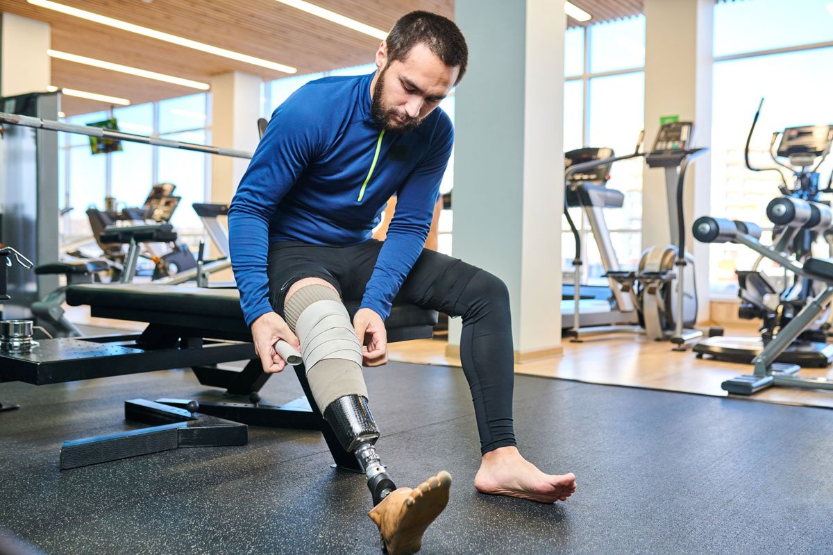 Prosthetics Guide 360° - The Future of Artificial Limbs