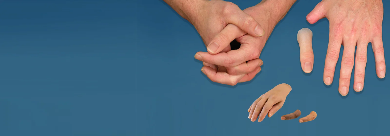 Rebuilt   Silicone Thumb Prosthesis 