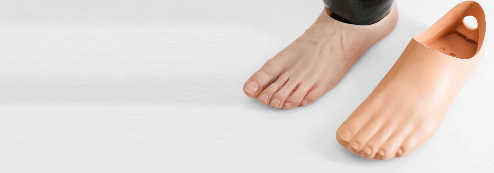 Rebuilt   Silicone Foot Prosthesis